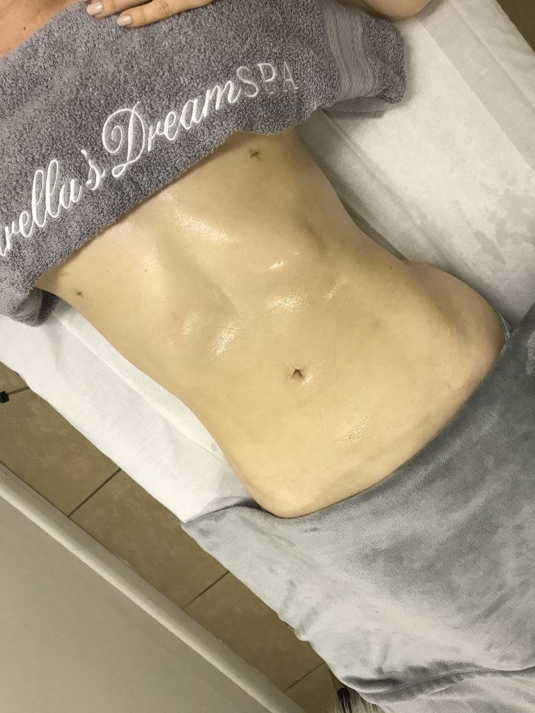 LYMPHATIC DRAINAGE | Estrella's Dream Spa | Hialeah, FL